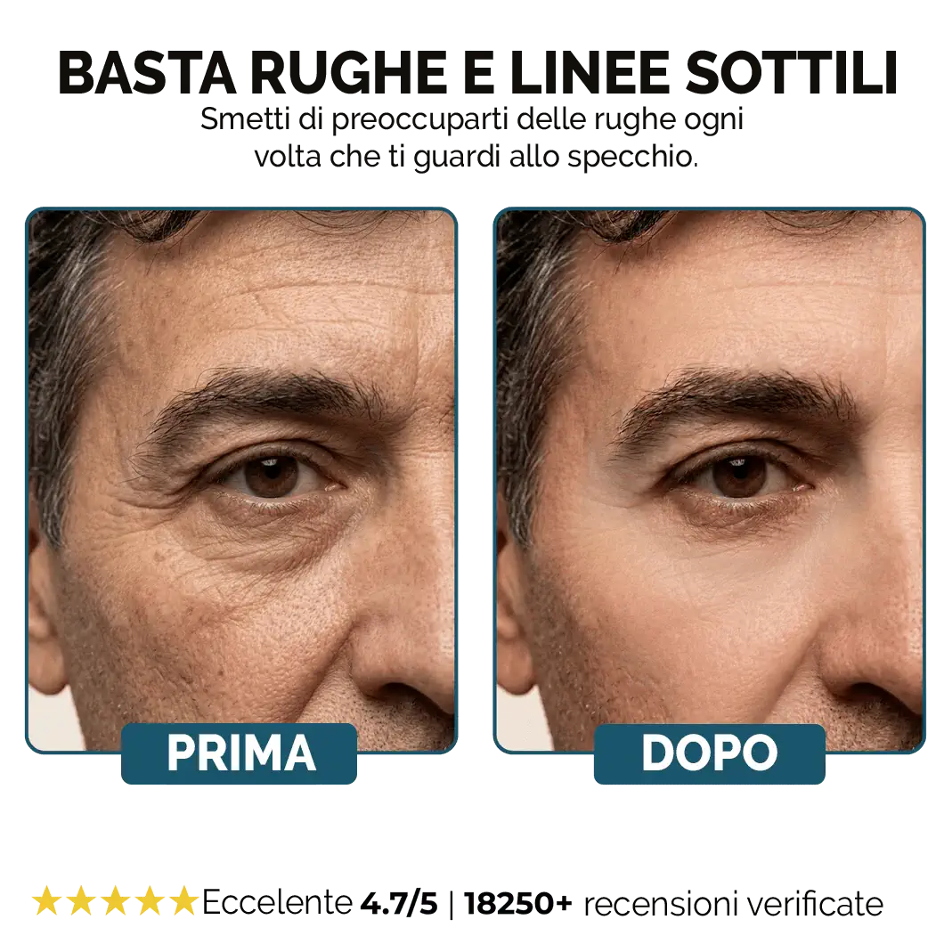 F-Balm™ Balsamo Antirughe‎